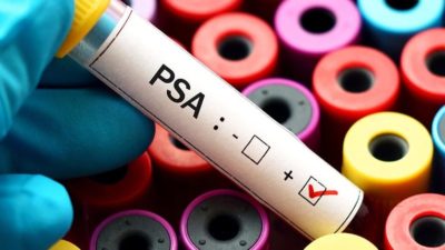 Improving Prostate Cancer Diagnosis